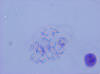 Chromosomes - Male 1000x